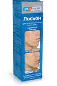 До і Після лосьйон анти-акне 200мл